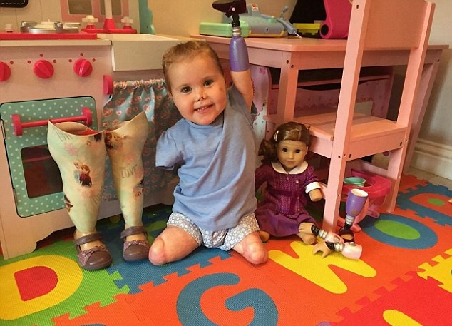 英2岁女婴失去四肢 母亲送假肢玩具助其重建信心