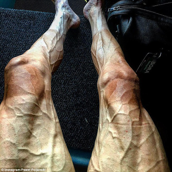 自行车运动员晒比赛后的双腿 血管异常凸起